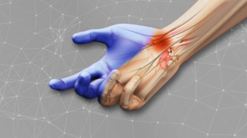3D  Nerve Tissue Implant