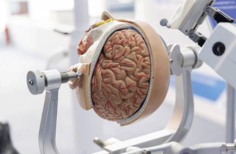 Robotic Assist 3D Brain model