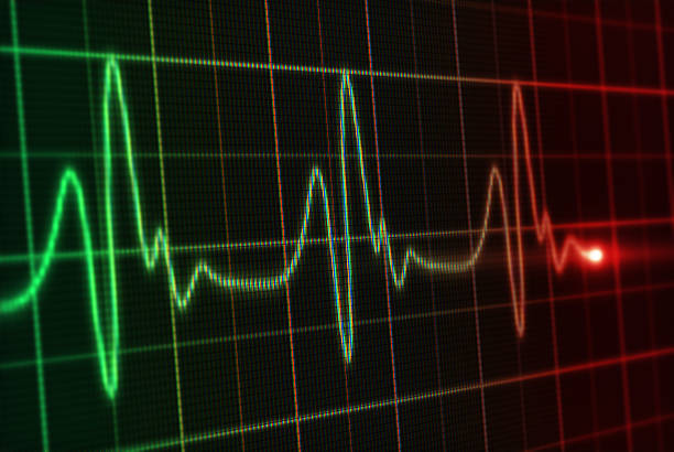 Real-time ECG Analysis