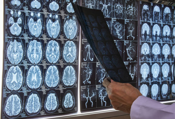 Prognosis Prediction in Traumatic Brain Injury